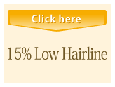 15% Low Hairline